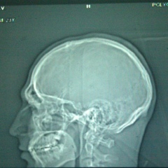 Александр Базаркин, 38 лет